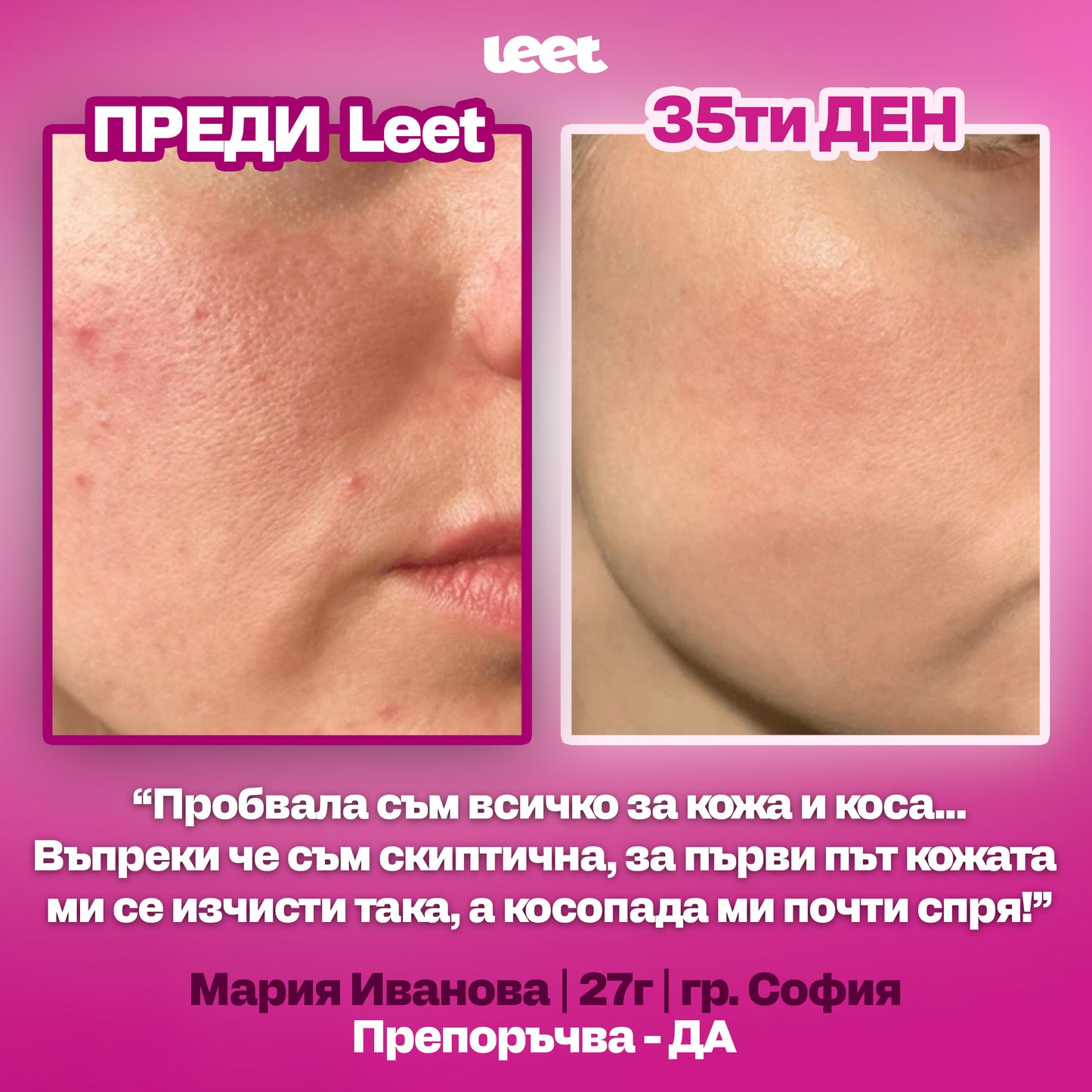 Leet Красота - 60 Дъвчащи бонбони с Колаген и Биотин