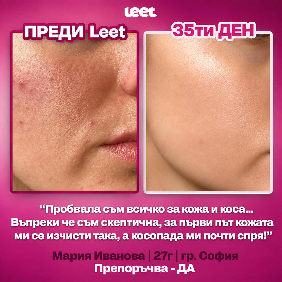 Leet Красота - 60 Дъвчащи бонбони с Колаген и Биотин